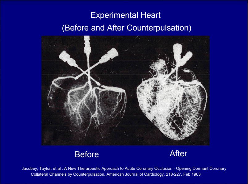 X-ray images showing an experimental heart before and after counterpulsation treatment.
